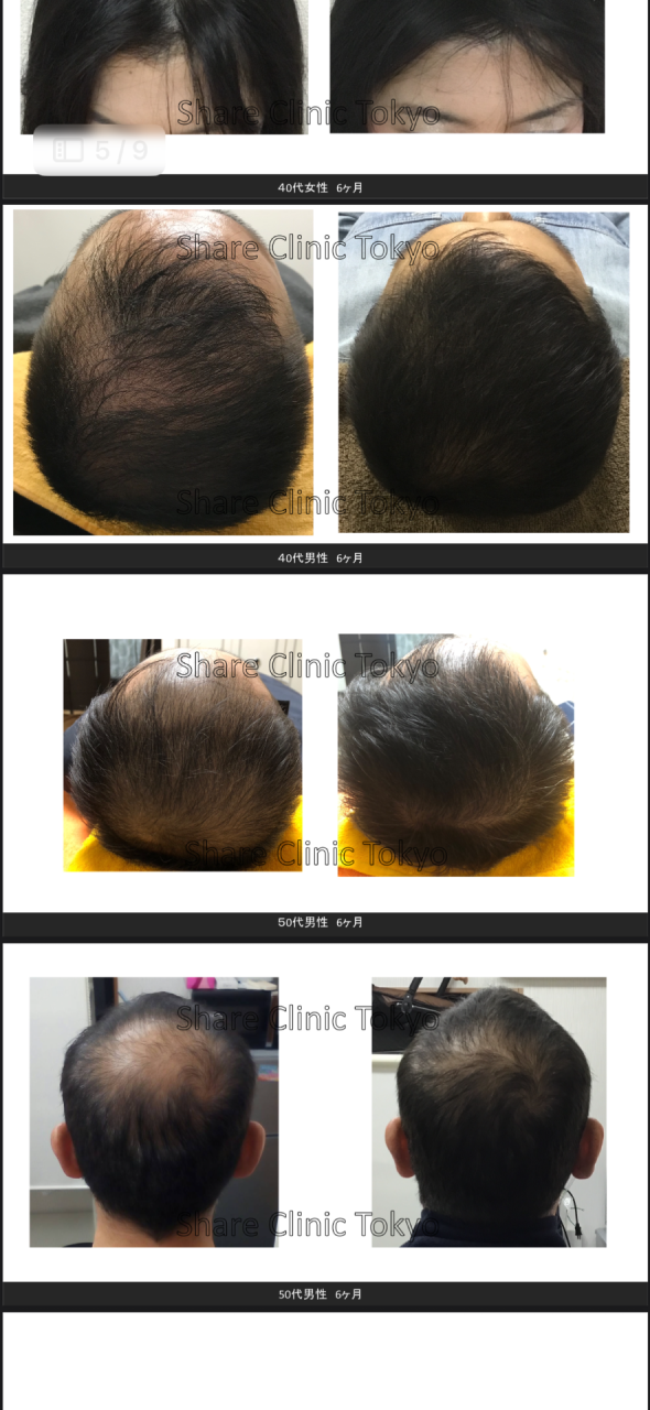 オンラインで始める発毛ケア──誰にも知られずにAGA治療が出来るオンラインクリニック！